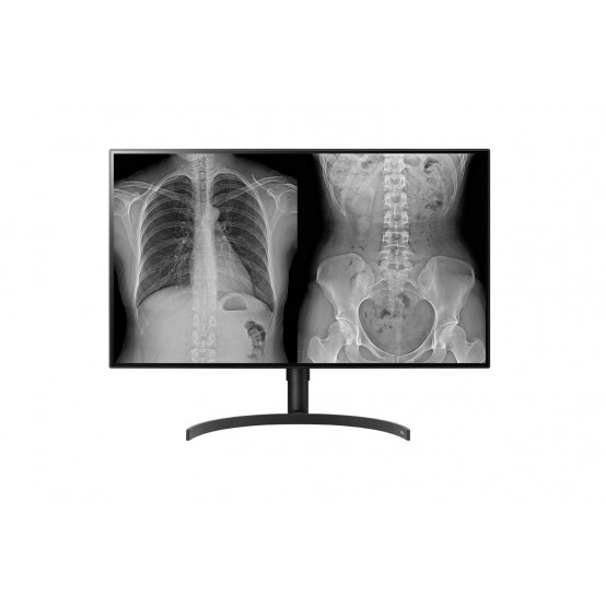 Monitor LG  32HL512D-B.AEU